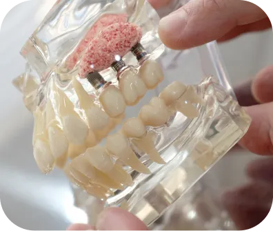 Bone grafting procedure