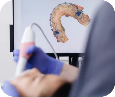 Digital dental scanner