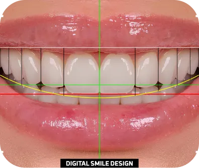 Digital smile design technology