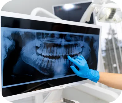 Digital dental x-rays
