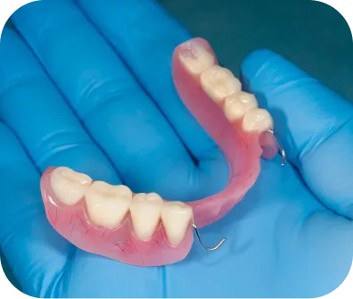 Partial dentures