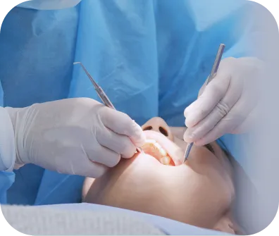 Scaling and root planing treatment