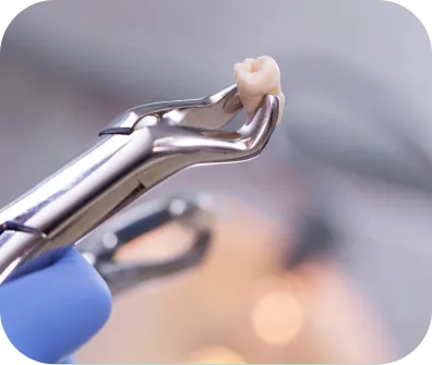 Tooth extractions
